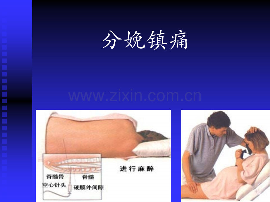 田英刚分娩镇痛.ppt_第1页