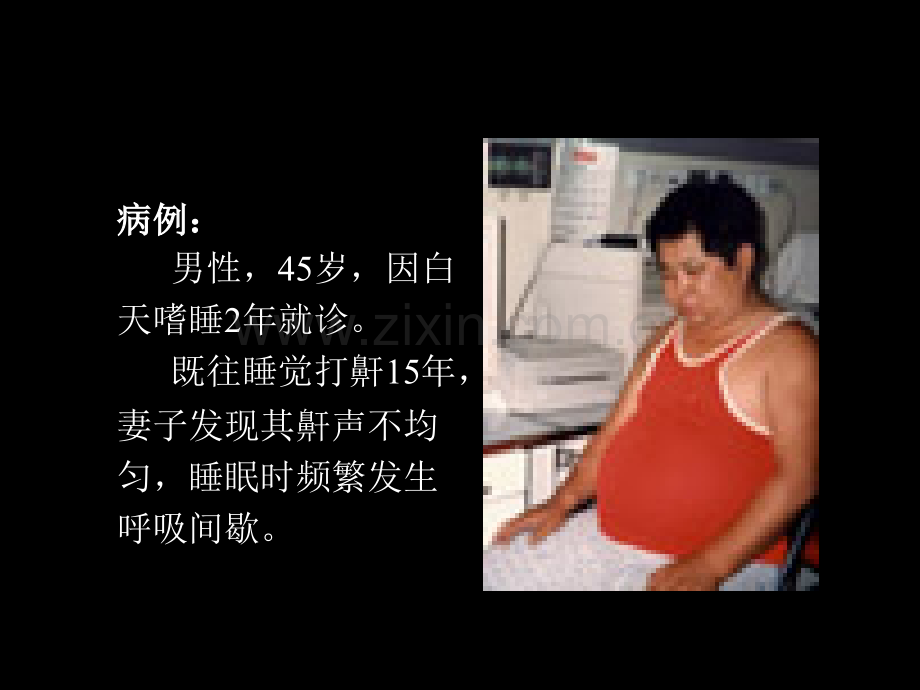 睡眠呼吸暂停低通气综合征的诊断及治疗.ppt_第2页