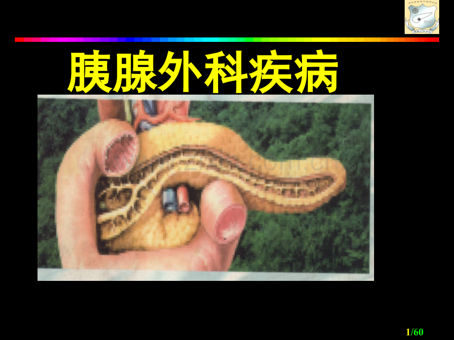 《胰腺外科疾病》.ppt_第1页