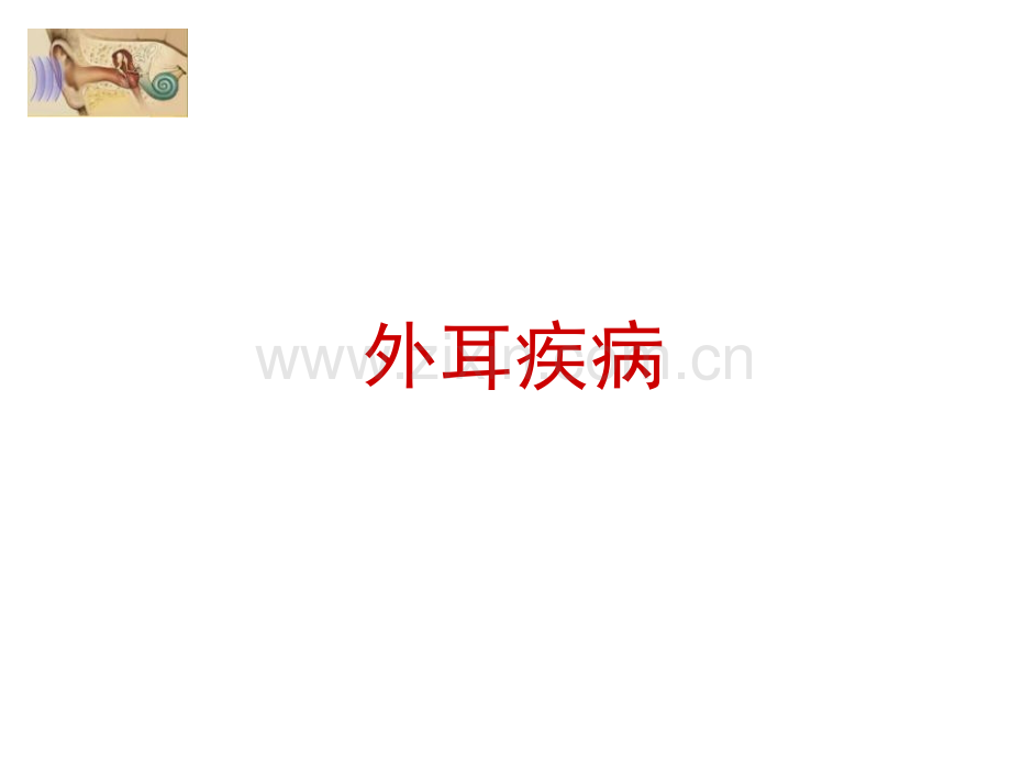 分泌性中耳炎.ppt_第2页