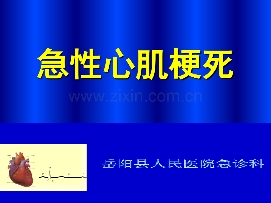 急性心肌梗死.ppt_第1页