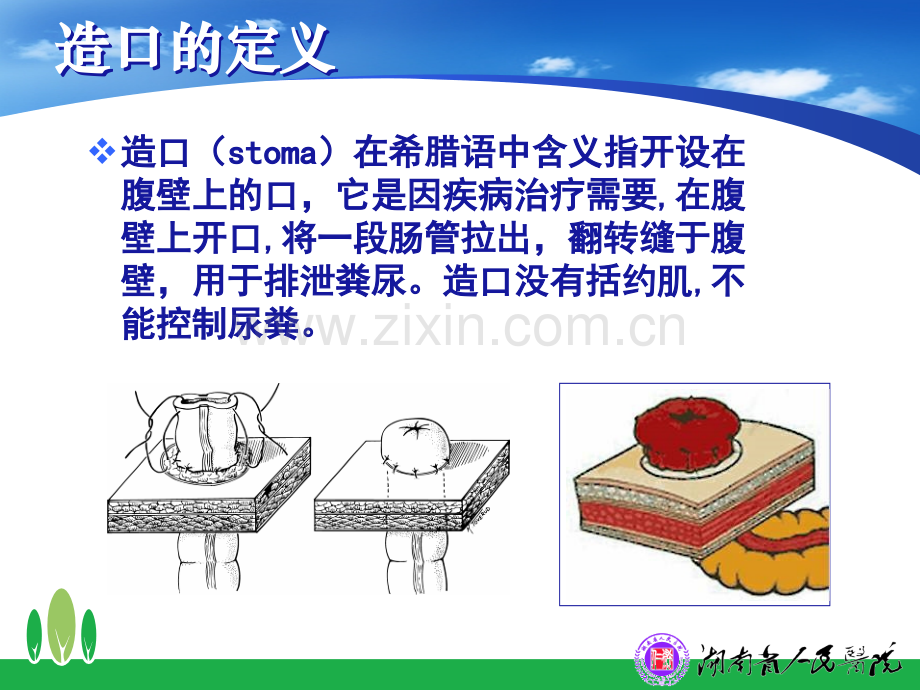 造口并发症的处理技巧.ppt_第2页