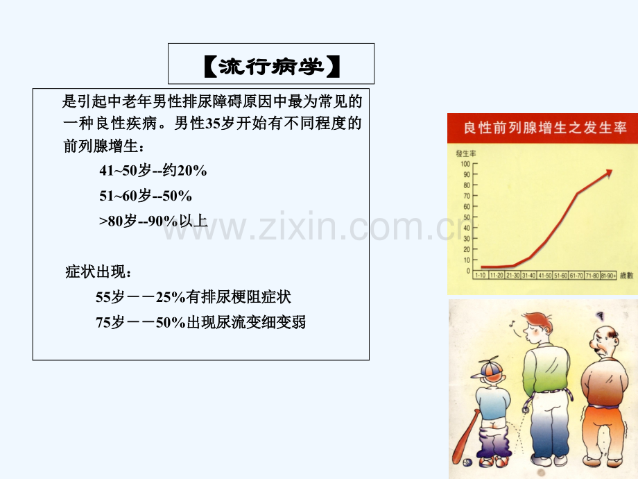 前列腺增生症-PPT.ppt_第2页