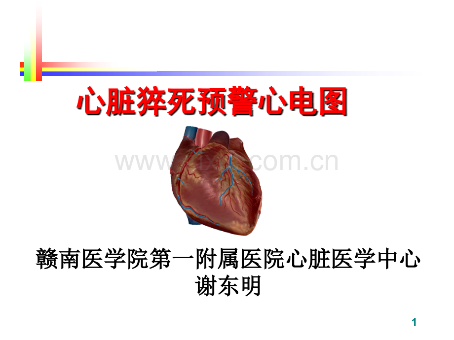 心脏猝死预警心电图(谢东明).ppt_第1页