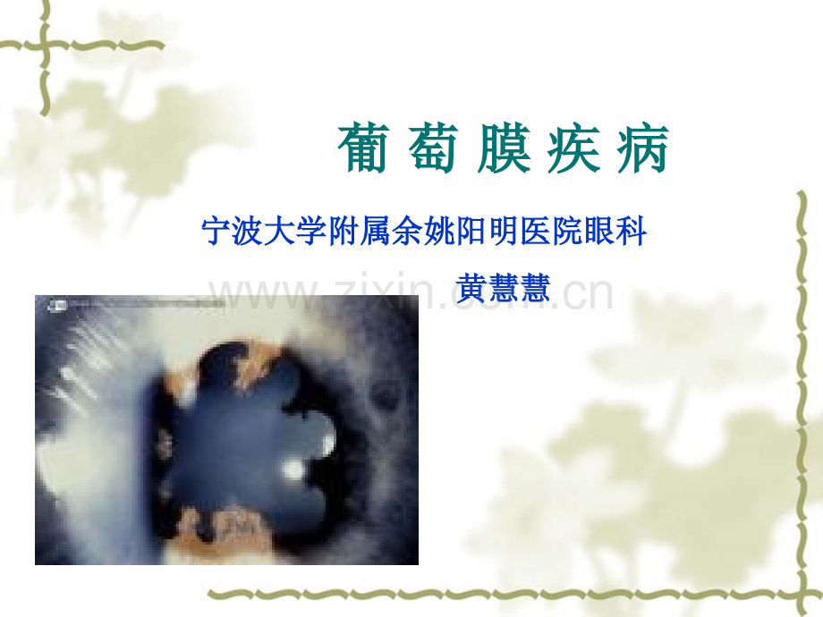 本葡萄膜病a.ppt_第1页
