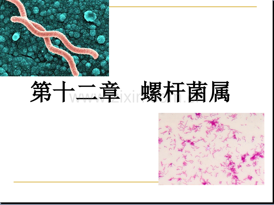 第十二章幽门螺杆菌.ppt_第1页
