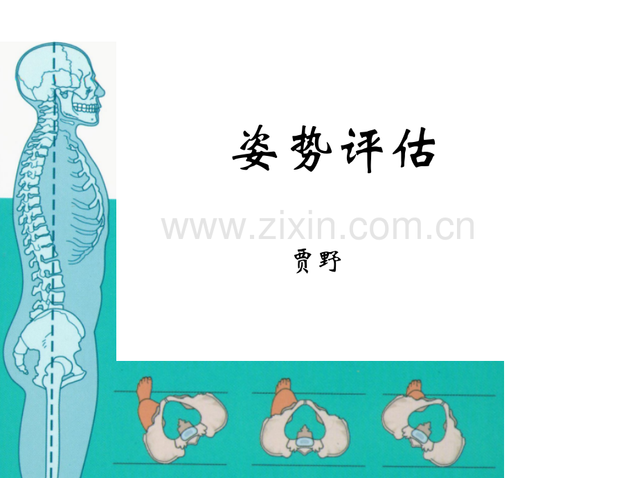 姿势评估贾野-PPT.ppt_第1页