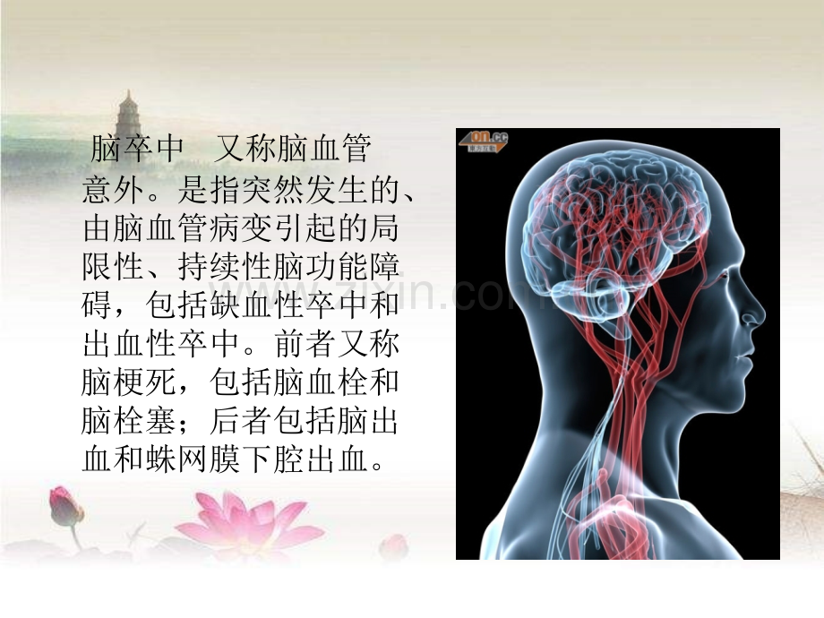 脑卒中早期康复-PPT.ppt_第2页