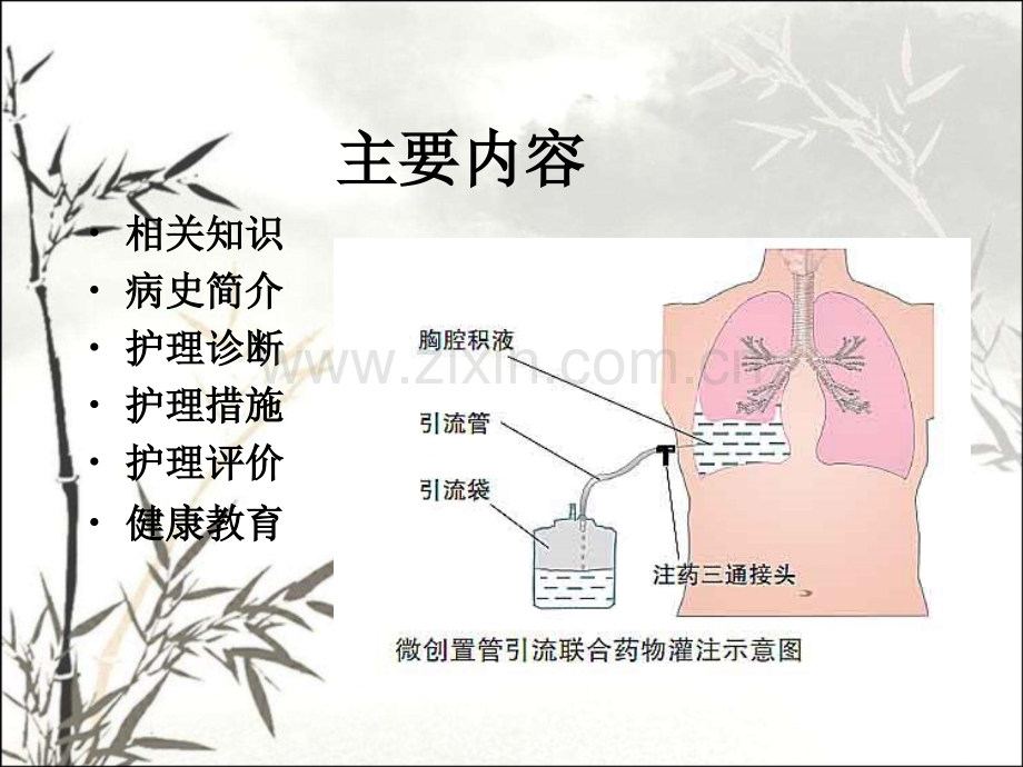 胸腔积液病人护理查房ppt课件.ppt_第2页