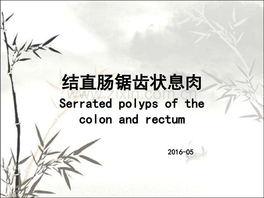结直肠锯齿状息肉ppt课件.ppt_第1页