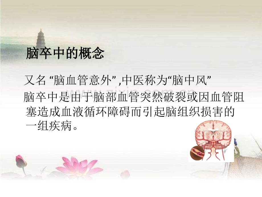 脑卒中防治知识讲座-PPT.ppt_第2页