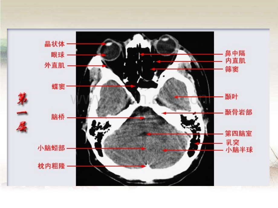 头颅CT影像解剖ppt.ppt_第2页