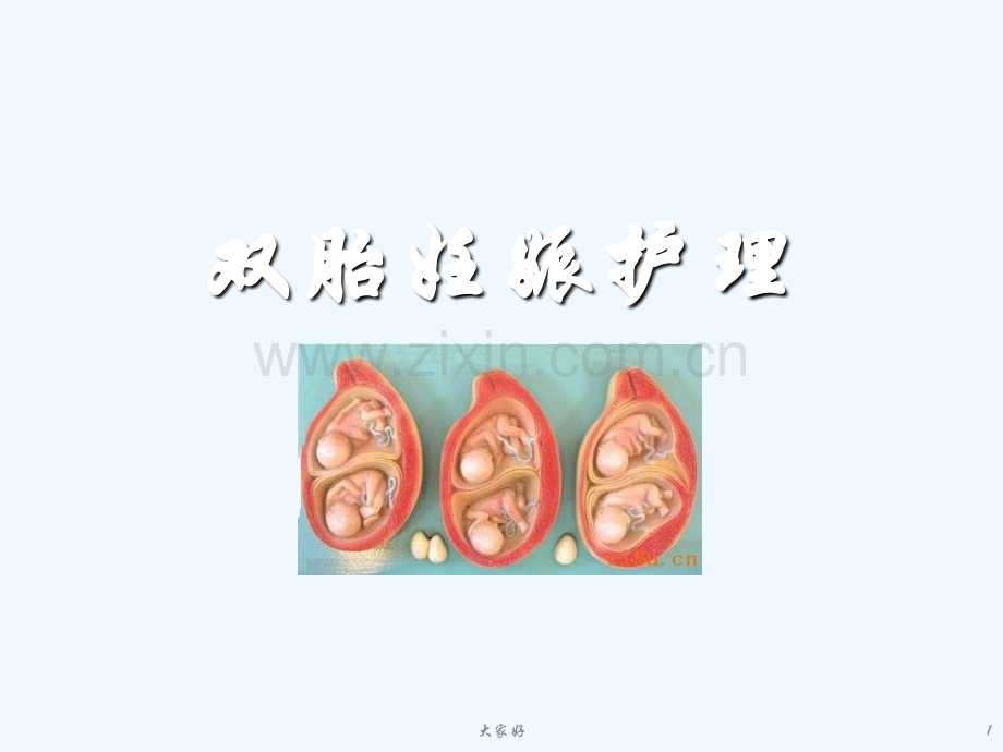 双胎妊娠护理-PPT.ppt_第1页