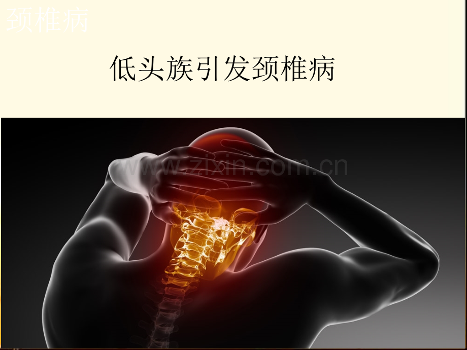 颈椎病安全宣讲-PPT.ppt_第2页
