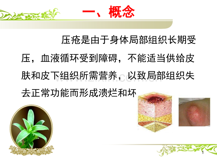 压疮的预防及护理-.pptx_第1页
