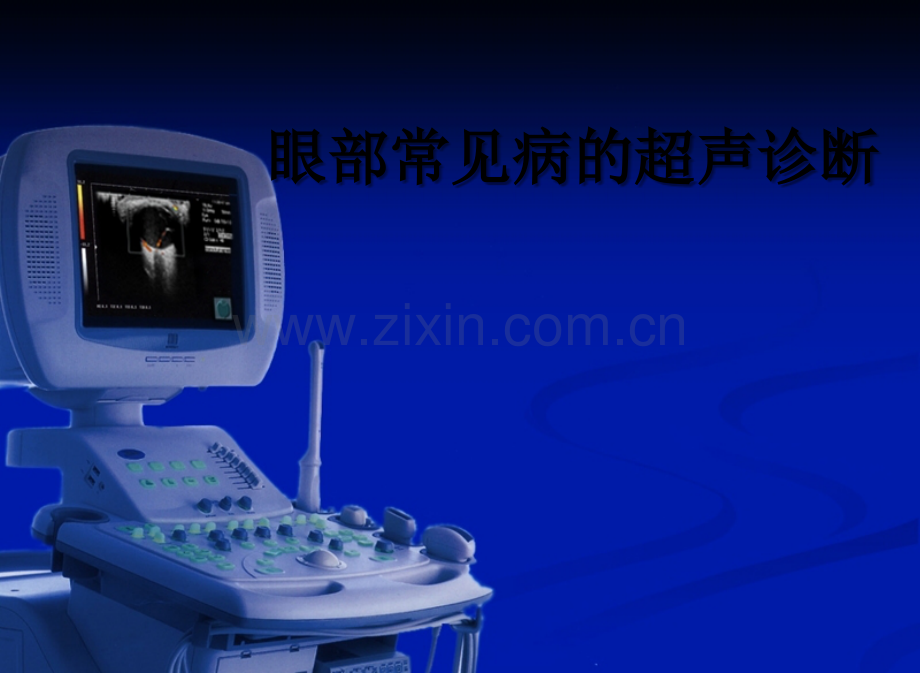 眼部常见病的超声诊断ppt.ppt_第1页