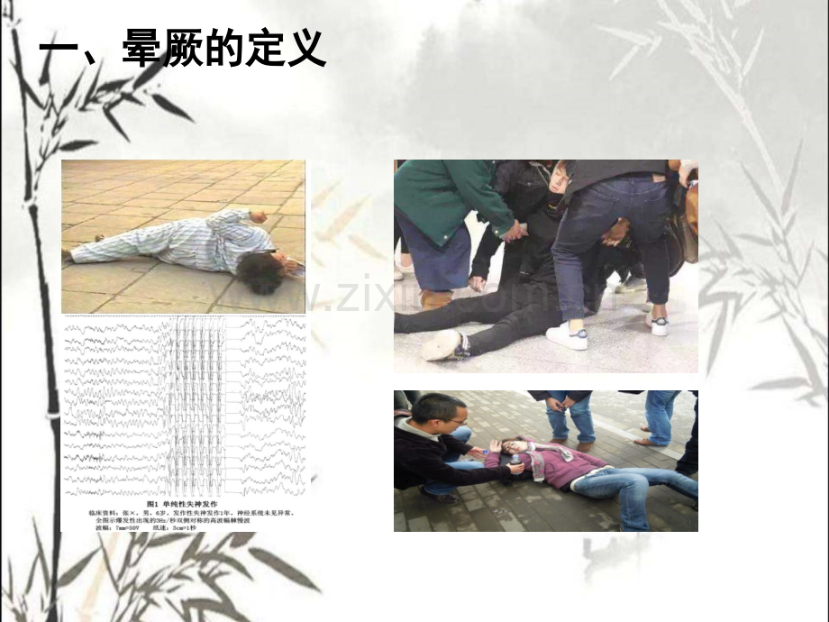 晕厥的诊断与治疗晕厥ppt.ppt_第2页