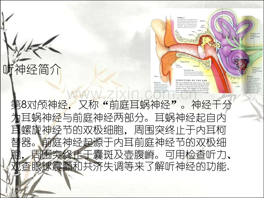 听神经瘤诊断ppt.ppt_第2页