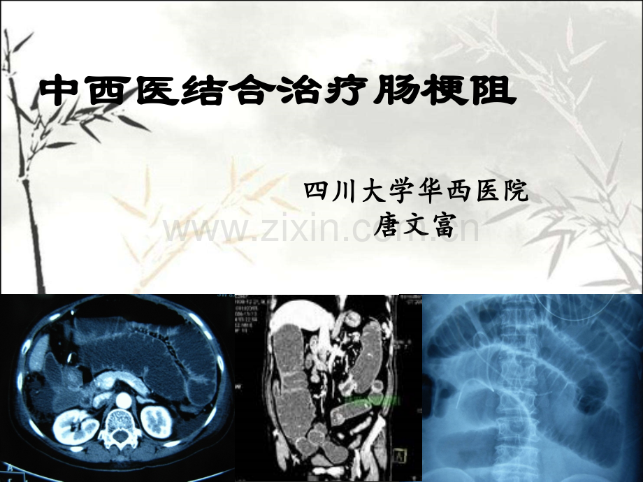 中西医结合治疗肠梗阻及循证证据ppt.ppt_第1页