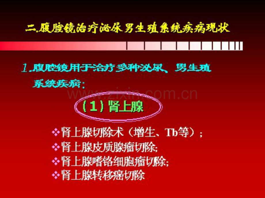 [指南]腹腔镜在泌尿外科医学应用近况及停顿1.ppt_第2页