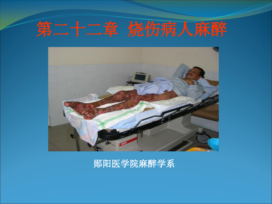 烧伤病毒人麻醉.ppt_第1页