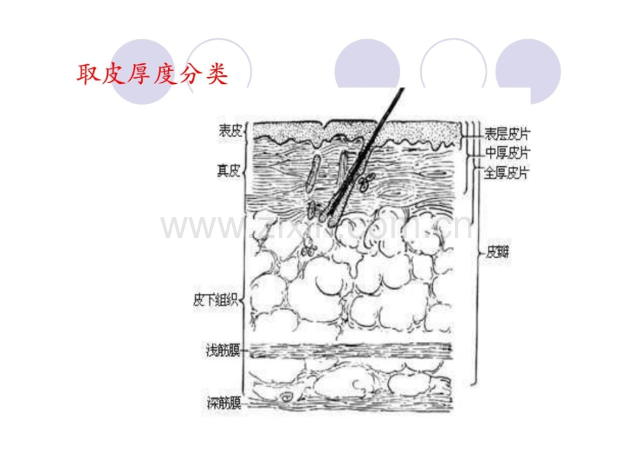 烧伤供皮区创面应用.ppt_第2页