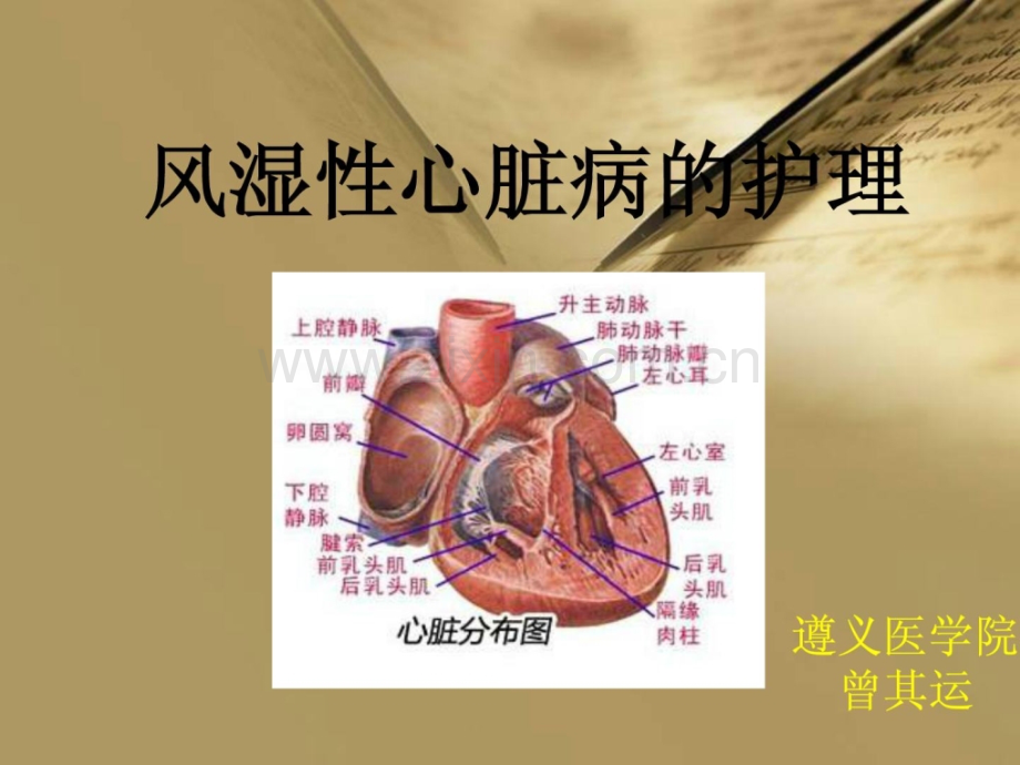 [指南]风湿性心脏病护理.ppt_第1页