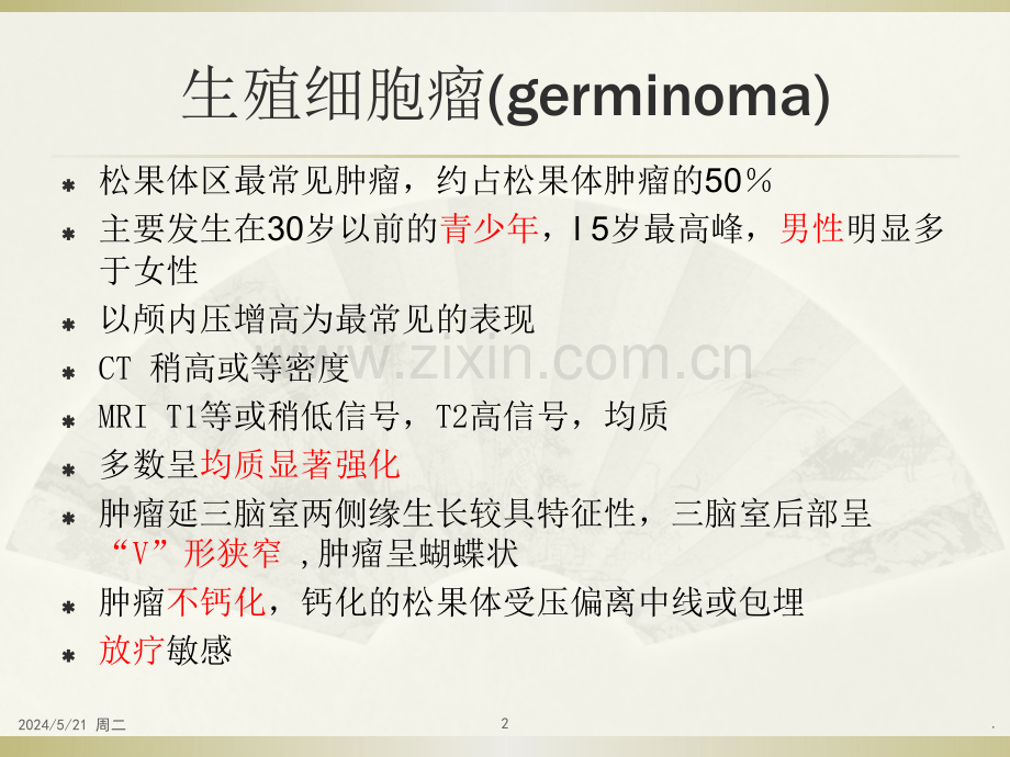 松果体肿瘤.ppt_第2页
