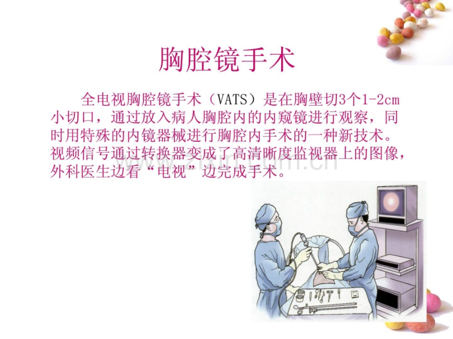 胸腔镜手术术前术后护理临床医学医药卫生专业资料.ppt_第2页