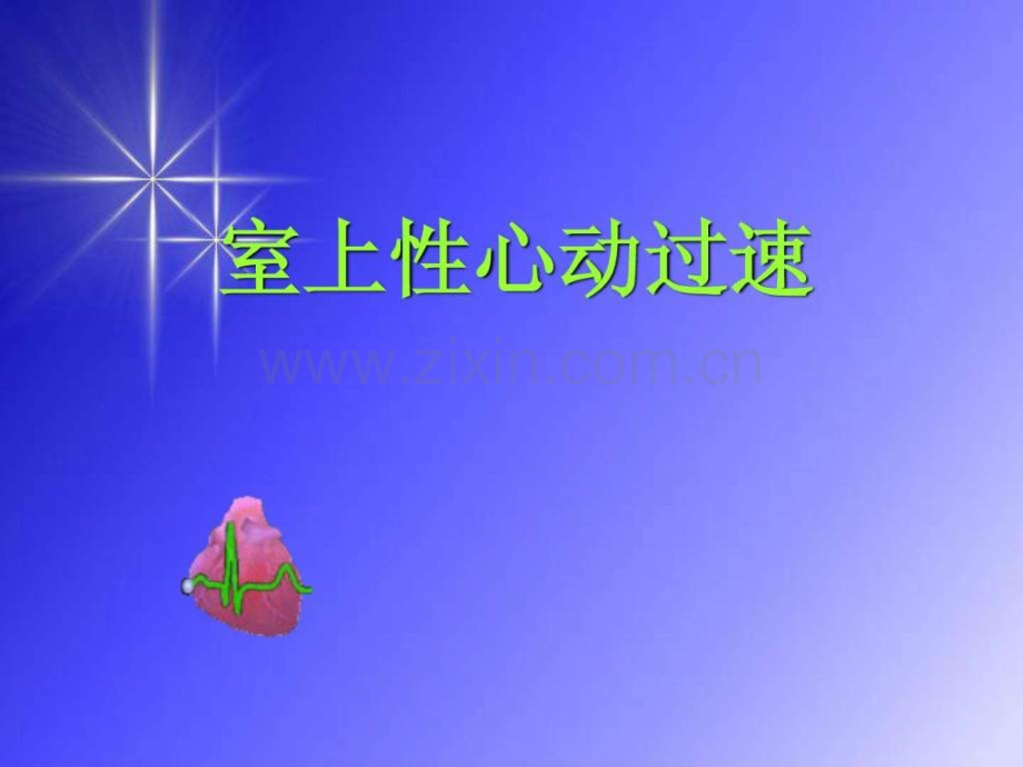 室上性心动过速心电图.ppt_第1页