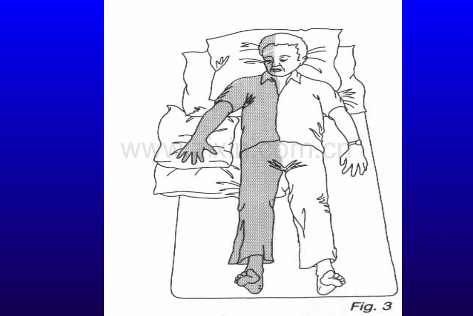 下肢康复方法.ppt_第2页