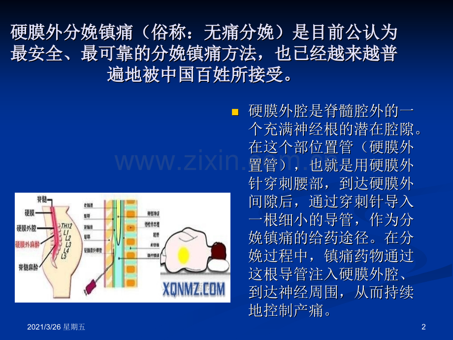 产后腰痛课件.ppt_第2页