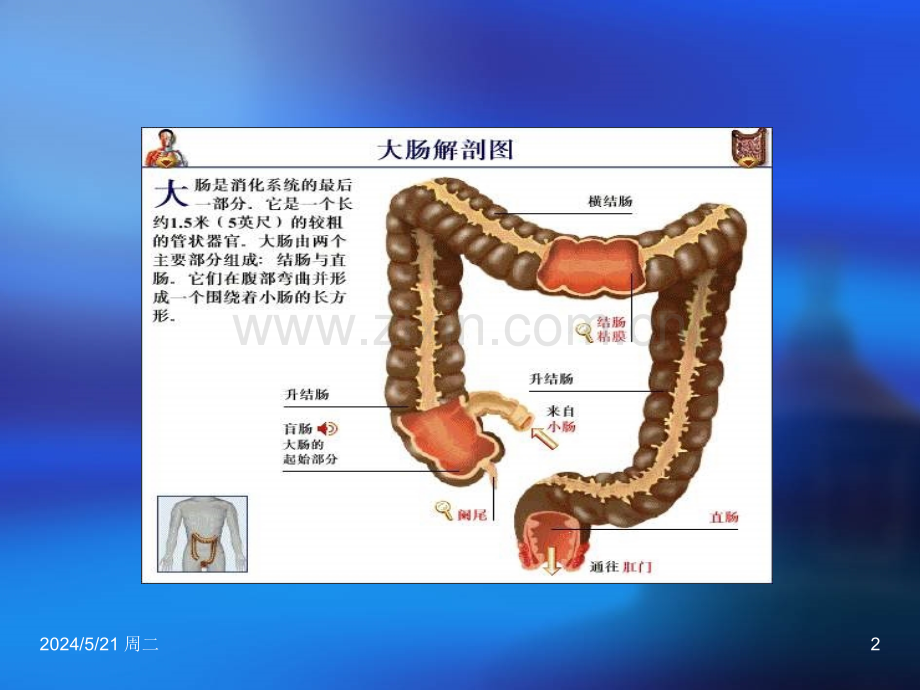 直肠癌护理汇总.ppt_第2页