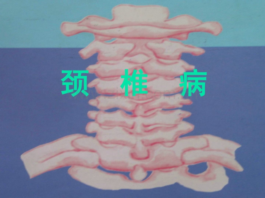 [指南]颈椎病概论.ppt_第1页