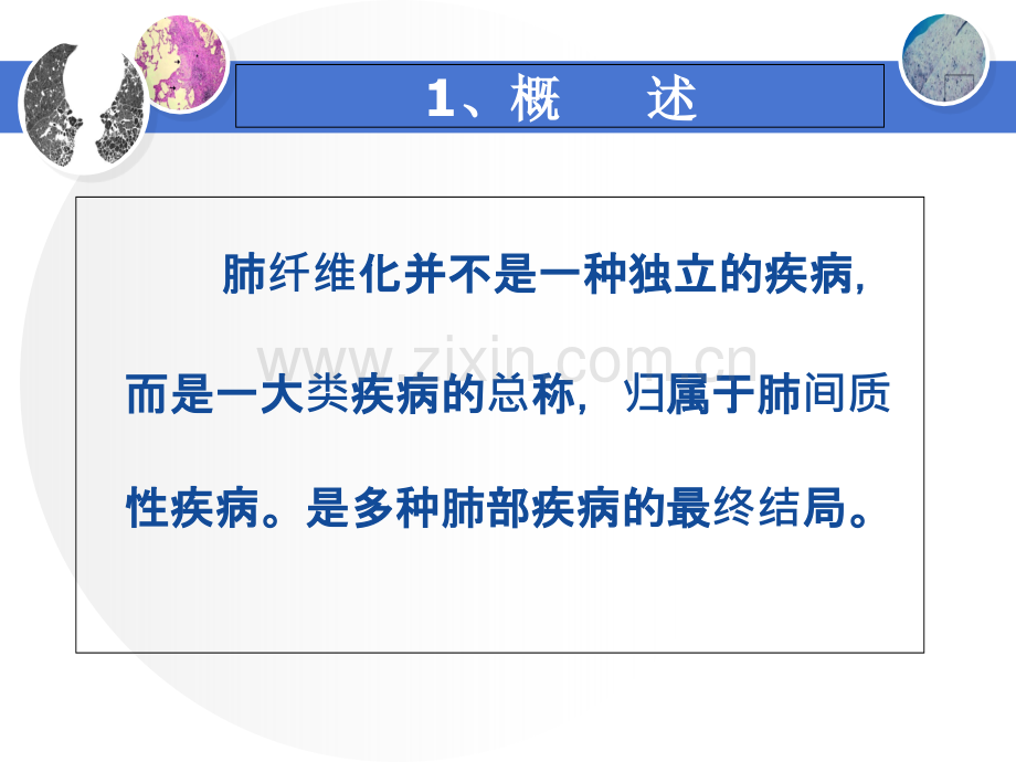 肺纤维化的特点.ppt_第2页