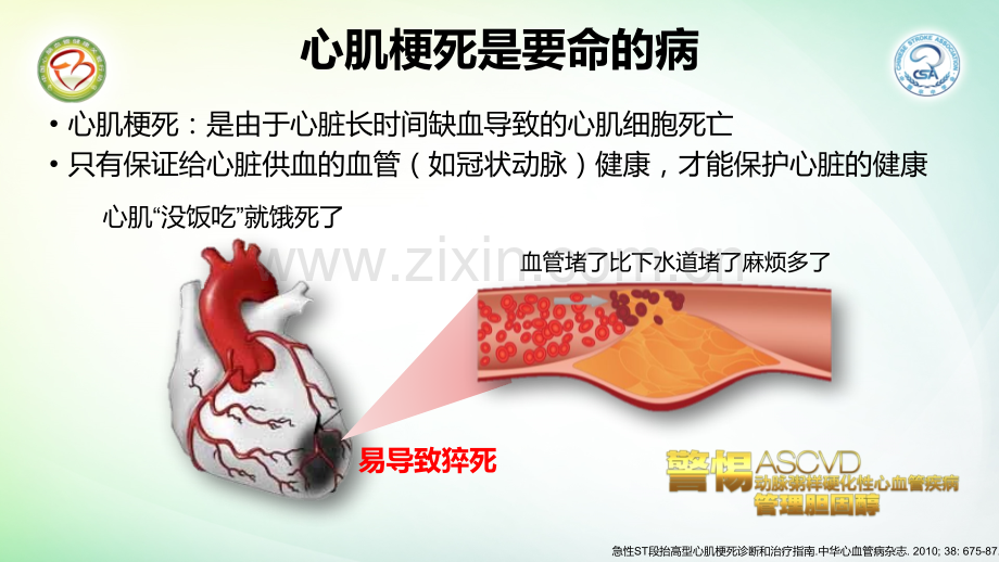 清晨血压与心肌梗死.pptx_第2页