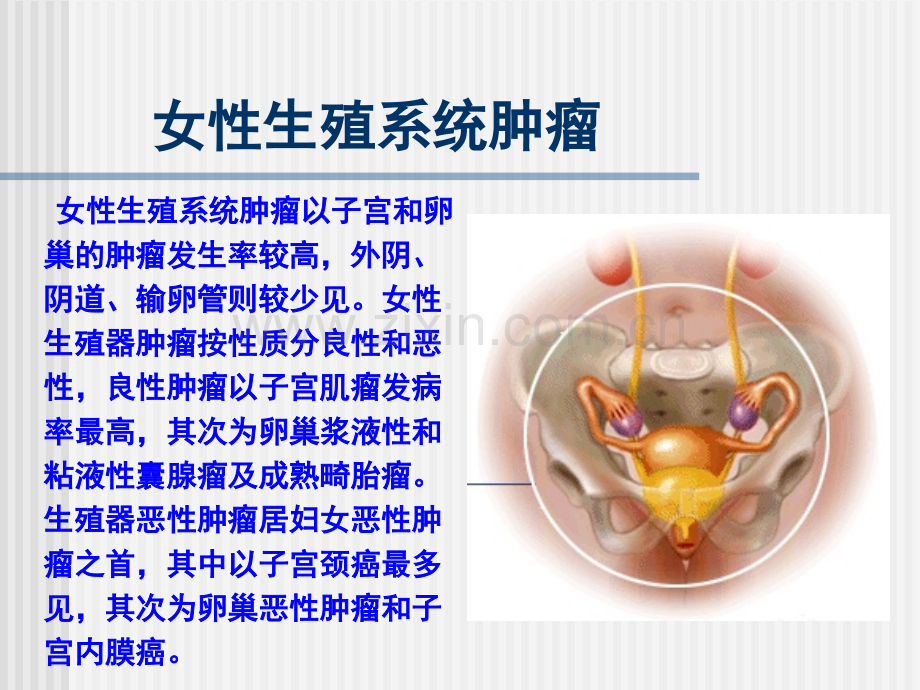 女性生殖系统肿瘤PPT课件.ppt_第2页