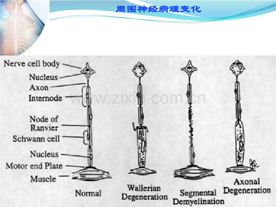 周围神经系统疾病1.ppt_第2页