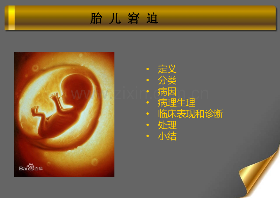 第四节胎儿窘迫.ppt_第2页
