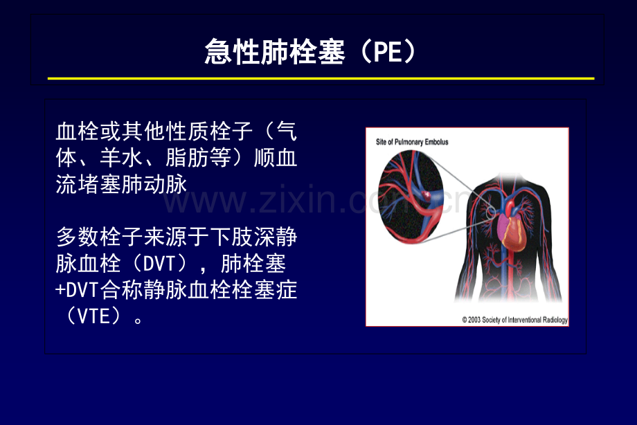肺栓塞诊断及鉴别诊断PPT课件.ppt_第2页