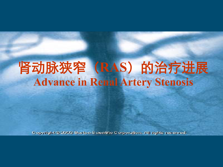 肾动脉狭窄(RAS)的治疗进展PPT课件.ppt_第1页