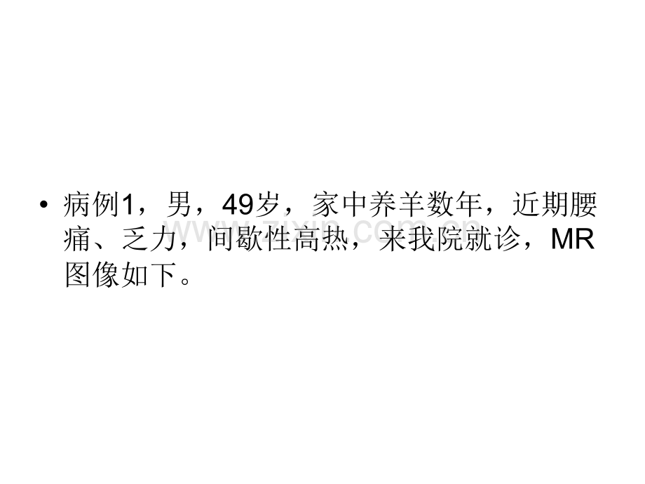 布病的骨关节改变.ppt_第2页