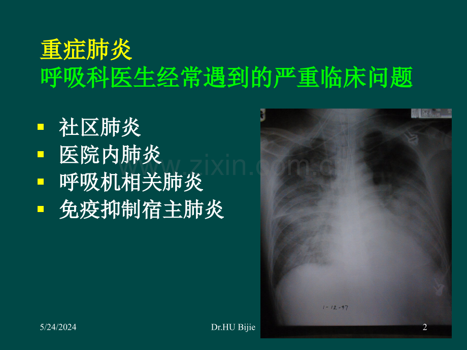 迎接挑战-重症肺炎究竟该如何诊治-PPT课件.ppt_第2页