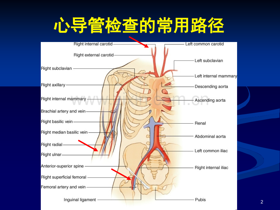 肺动脉造影与急性肺血管反应试验.ppt_第2页