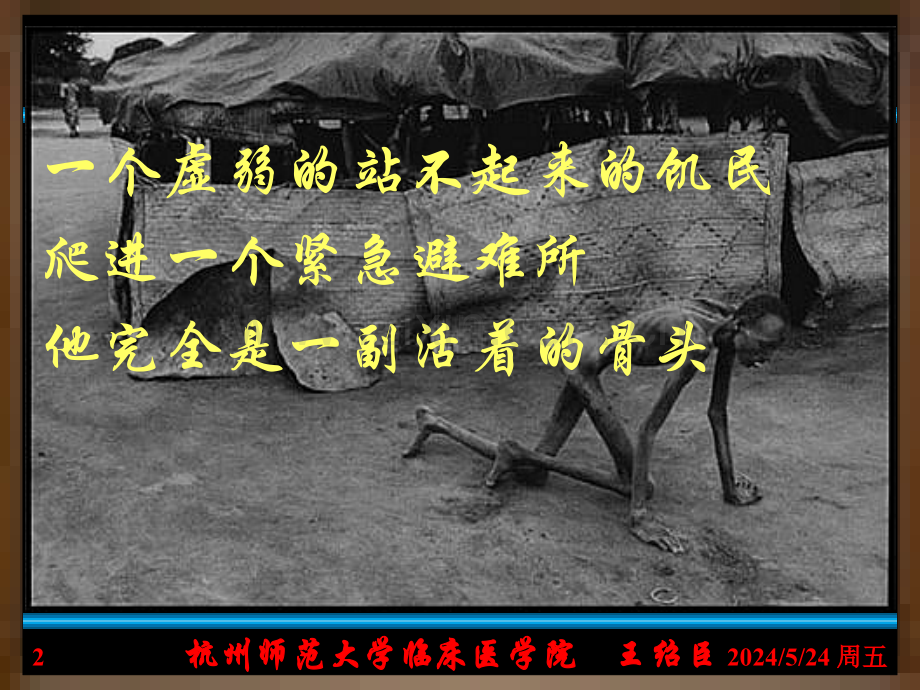 6.营养素失衡与疾病1.ppt_第2页