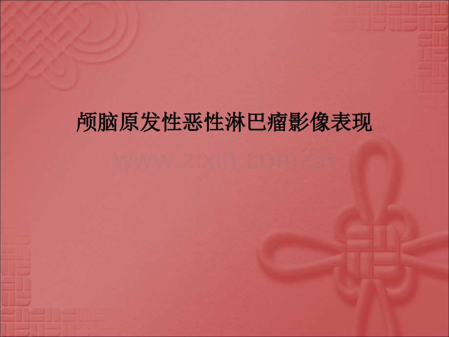 颅脑原发性恶性淋巴瘤影像表现.ppt_第1页