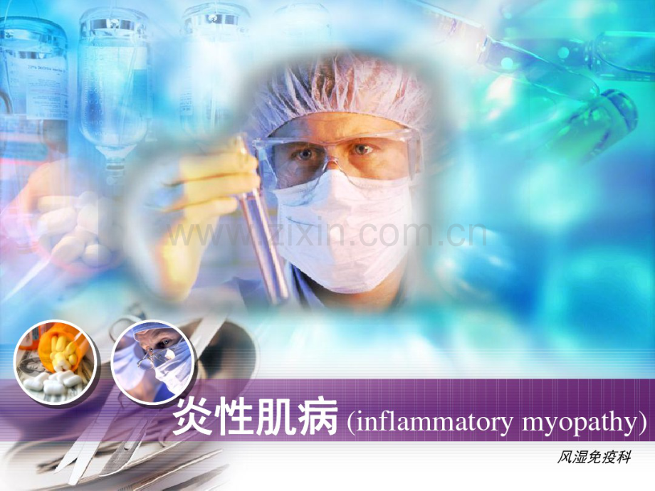 特发性炎症性肌病-(2).pdf_第2页