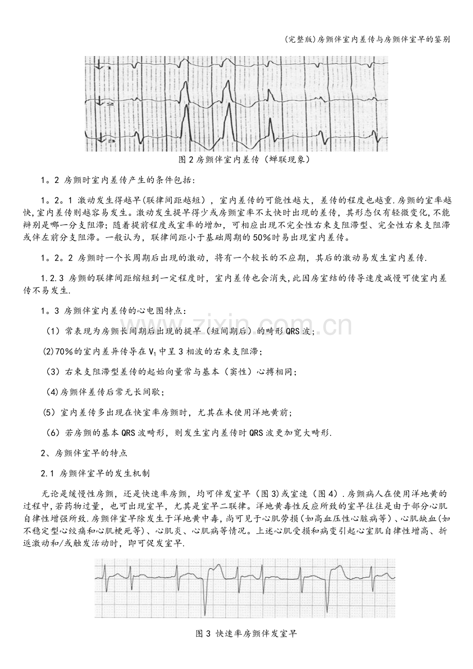房颤伴室内差传与房颤伴室早的鉴别.doc_第2页