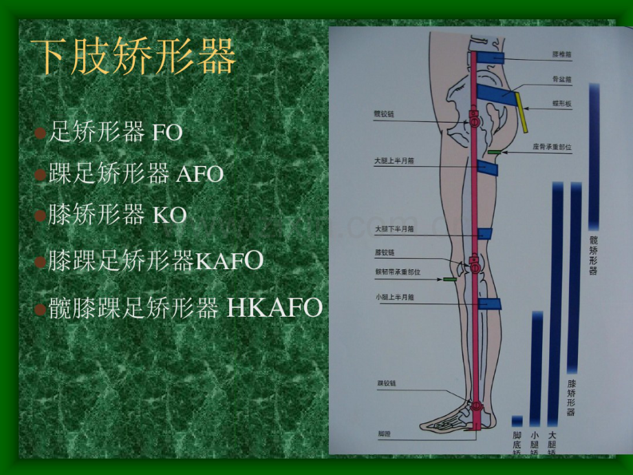 下肢矫形器的种类与应用.pdf_第2页