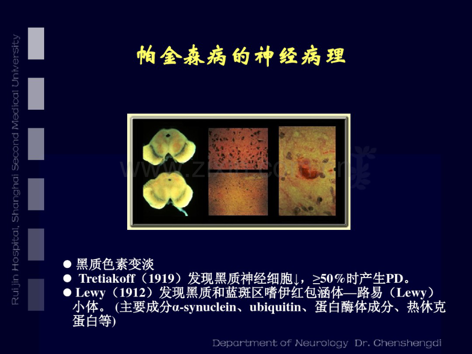 帕金森病诊断与治疗指南-07-7-29.pdf_第2页
